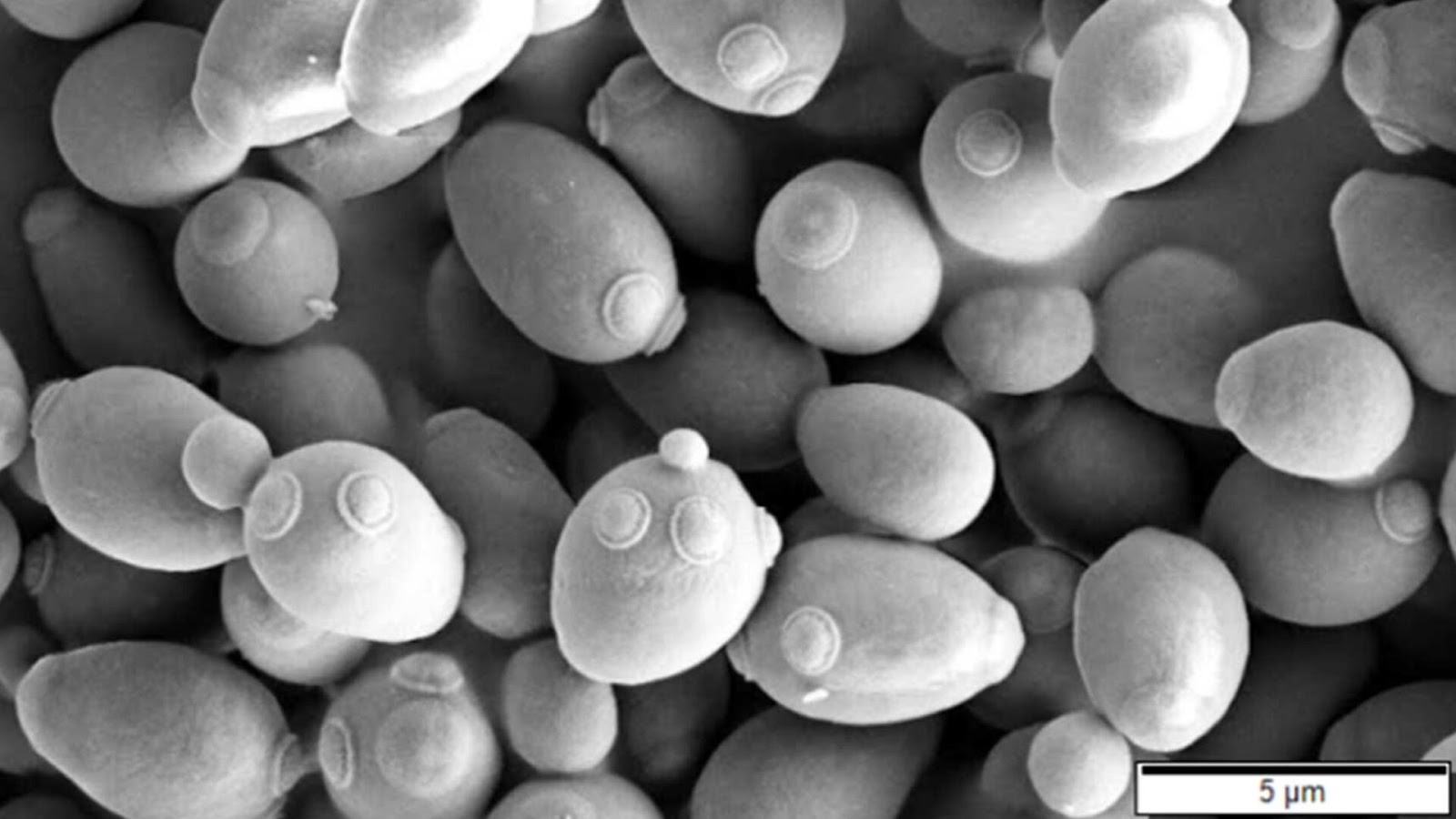 Budding yeast as seen under the microscope. Credits: Mogana Das Murtey and Patchamuthu Ramasamy, CC BY 3.0 via Wikimedia Commons