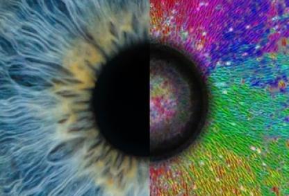 Human eye (left half) and Radial alignment of cells on a soft inhomogeneous substrate with an embedded glass bead at the center (right half) Credits: Michael Morse via pexels and Dr Akshada Khadpekar. (Lead author of the study)