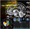 Brain tumor protein